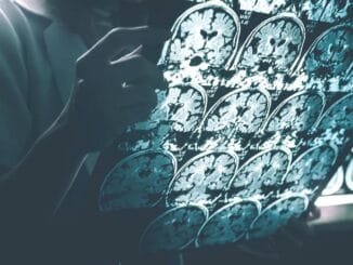 Alzheimer Hastalığının Tarihçesi ve Yeni Araştırmalar - MakineTamir