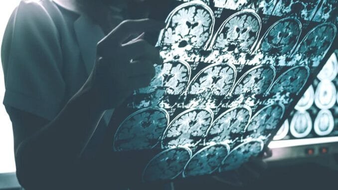 alzheimer-hastaliginin-tarihcesi-ve-yeni-arastirmalar-zVyc6kVi.jpg