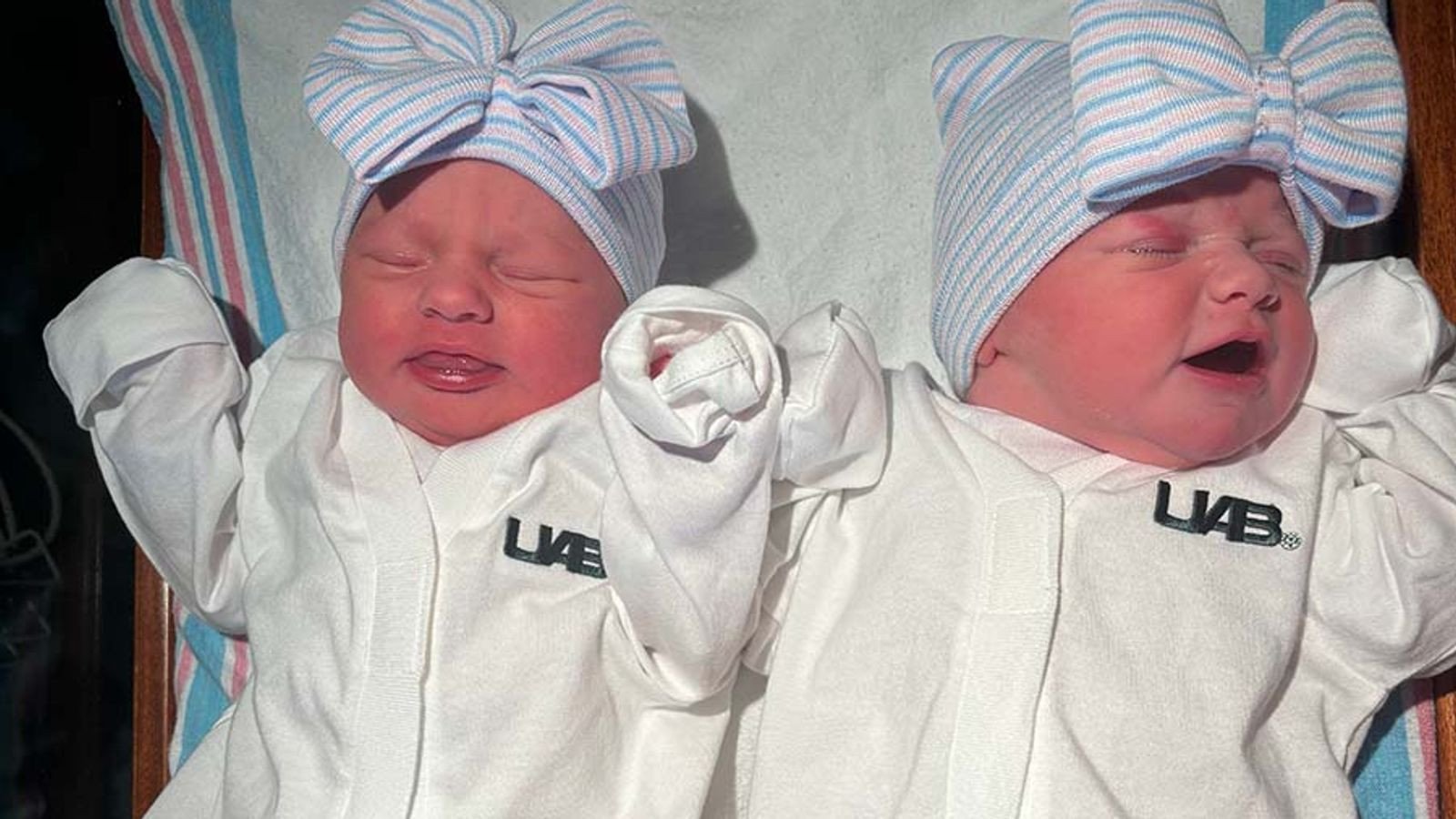 İkiz Hamilelik: Milyonda Bir İhtimal